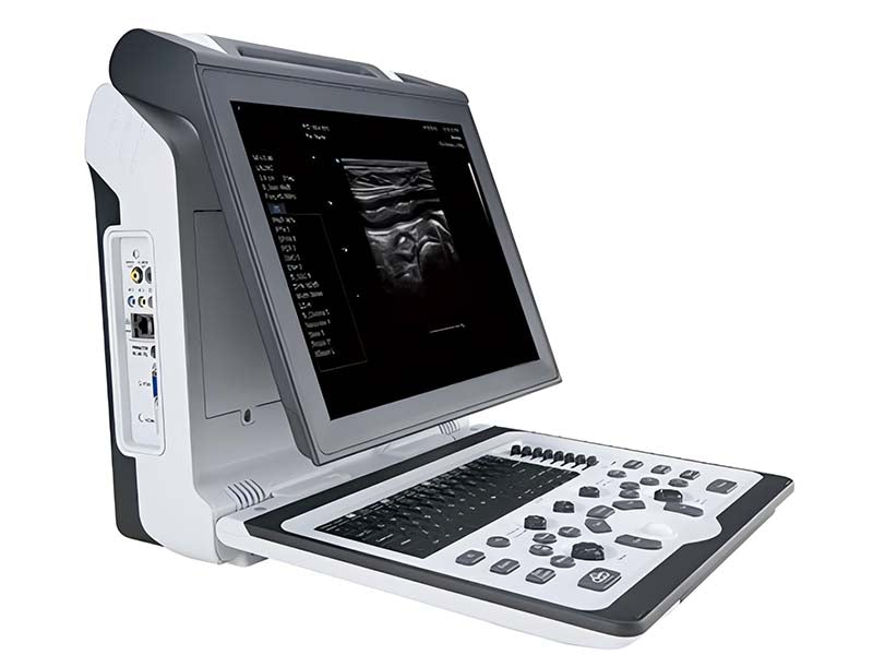 GHM 2300V Portable Veterinary Color Doppler Ultrasound Standard Configuration + Micro convex(4.5-7.5MHz) + Linear(5.0-12.0MHz)