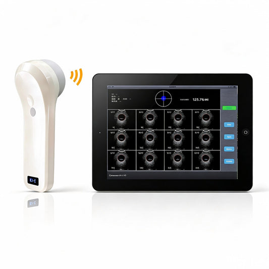 Global Healthcare Medical wireless 4D bladder scanner with single probe design for rapid bladder volume measurement