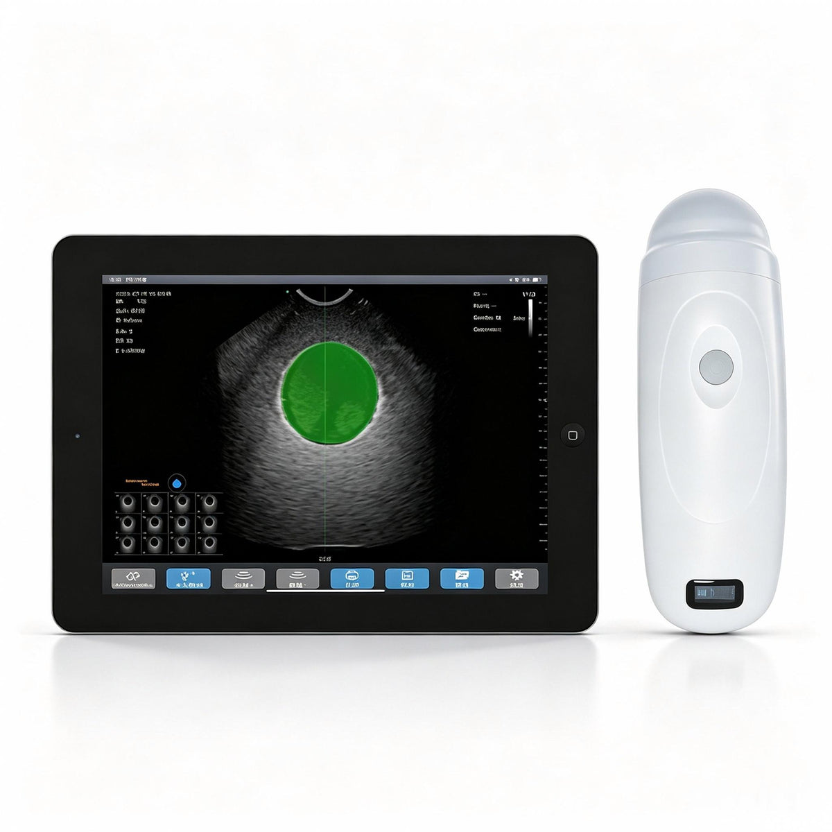 Global Healthcare Medical wireless 4D bladder scanner with single probe design for rapid bladder volume measurement