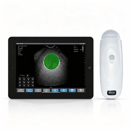 Global Healthcare Medical wireless 4D bladder scanner with single probe design for rapid bladder volume measurement