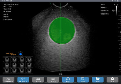 Global Healthcare Medical wireless 4D bladder scanner with single probe design for rapid bladder volume measurement