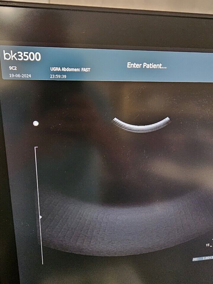 BK Medical BK3500 Ultrasound With 9C2 Probe -2017 #