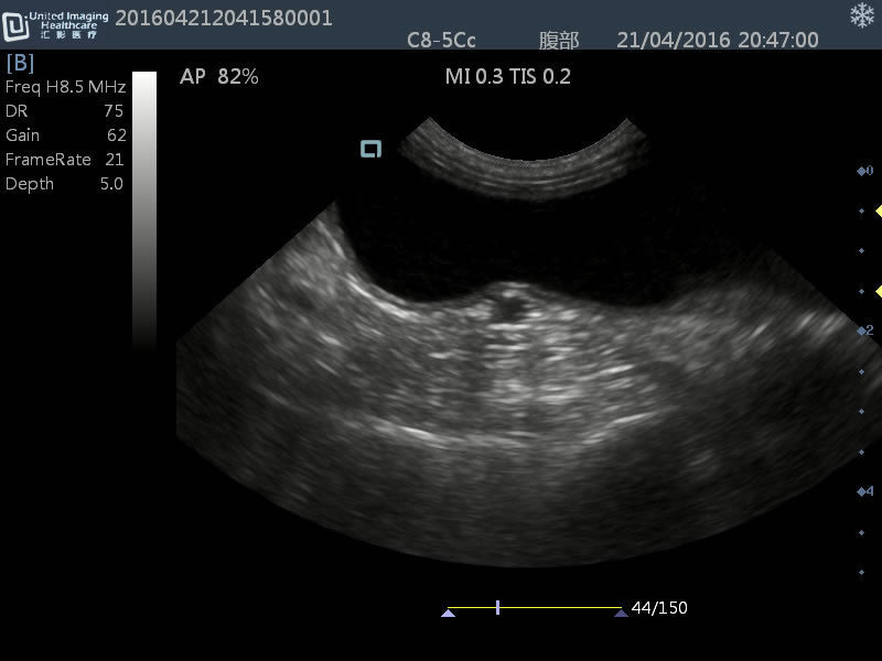 iuStar 100Vet B&W Ultrasound #