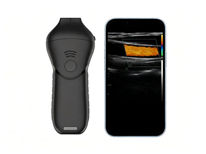 High-Frequency Linear Ultrasound Probe | 16-20 MHz Wireless Aesthetic Imaging for Facial Injections