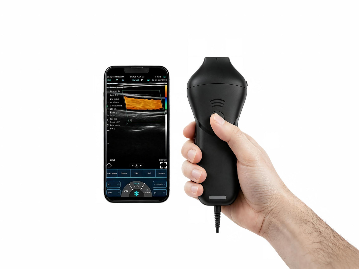 High-Frequency Linear Ultrasound Probe | 16-20 MHz Wireless Aesthetic Imaging for Facial Injections