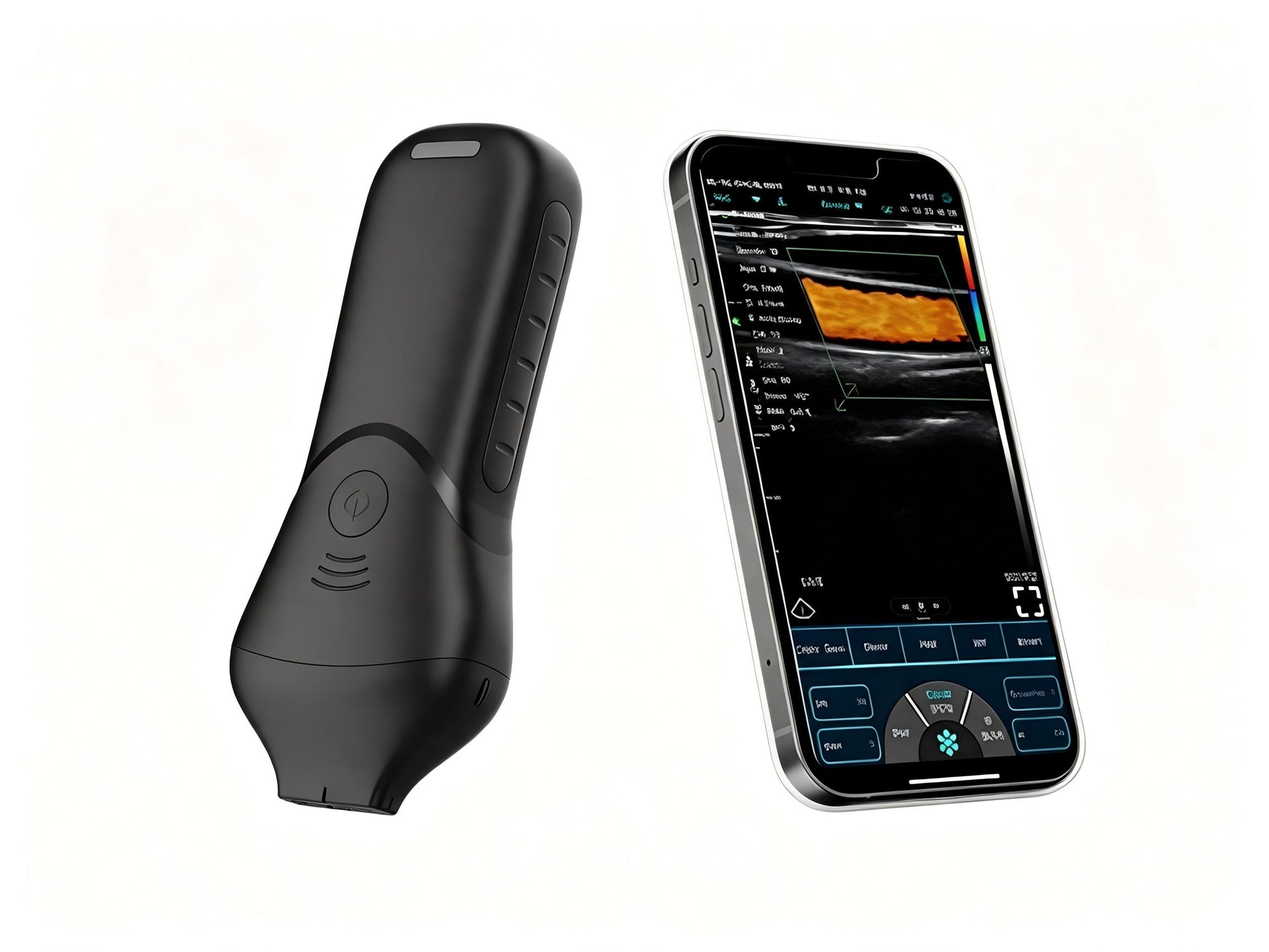 Global Healthcare Medical High-Frequency Linear Ultrasound Probe for Aesthetics – 16-20 MHz Wireless Facial Imaging