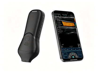 Global Healthcare Medical High-Frequency Linear Ultrasound Probe for Aesthetics – 16-20 MHz Wireless Facial Imaging