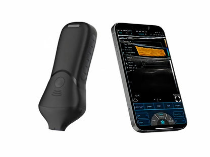 Global Healthcare Medical High-Frequency Linear Ultrasound Probe for Aesthetics – 18-24 MHz Wireless Facial Imaging