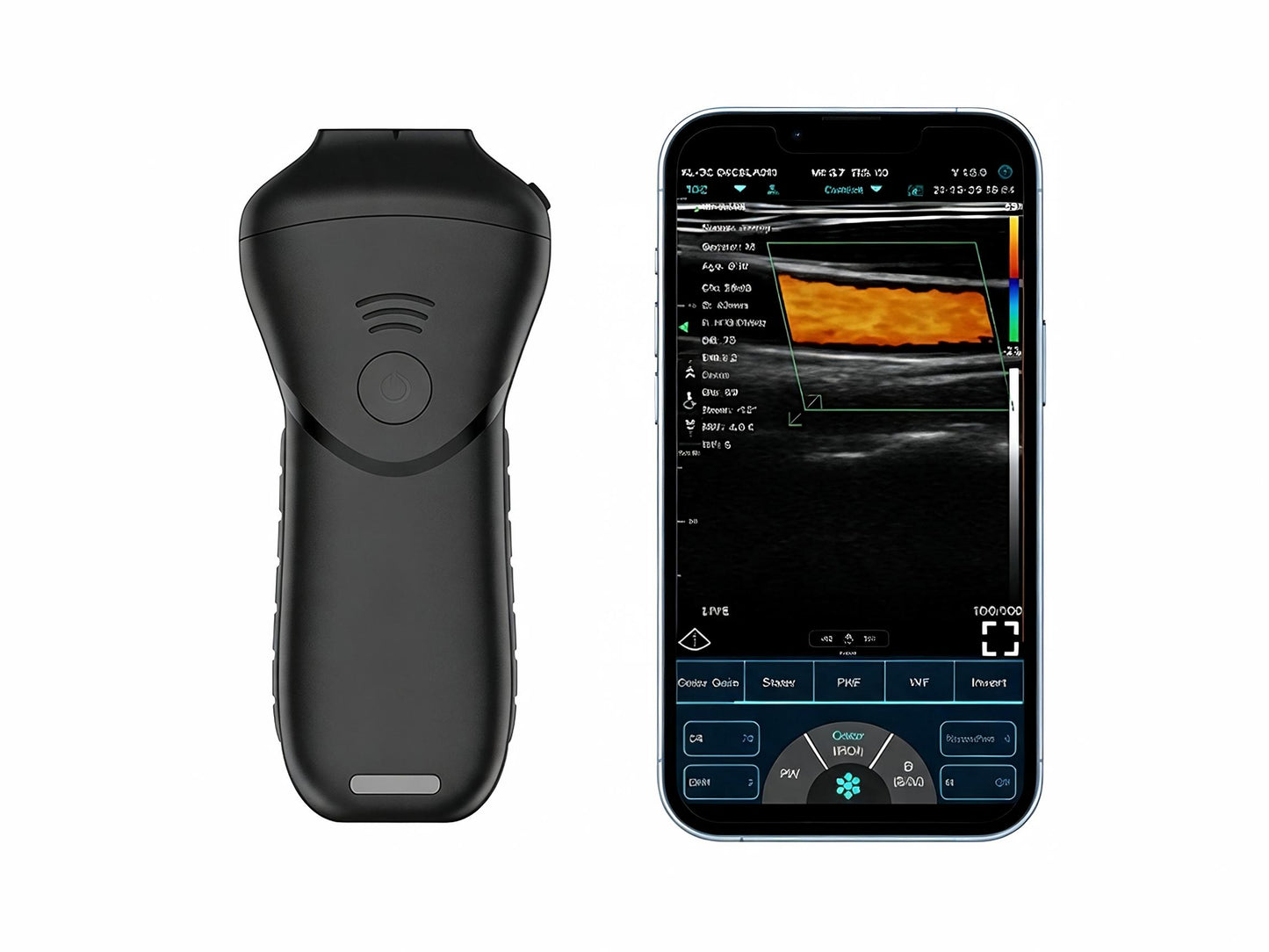 High-Frequency Linear Ultrasound Probe | 192-Element Wireless Imaging for Superficial & Aesthetic Use