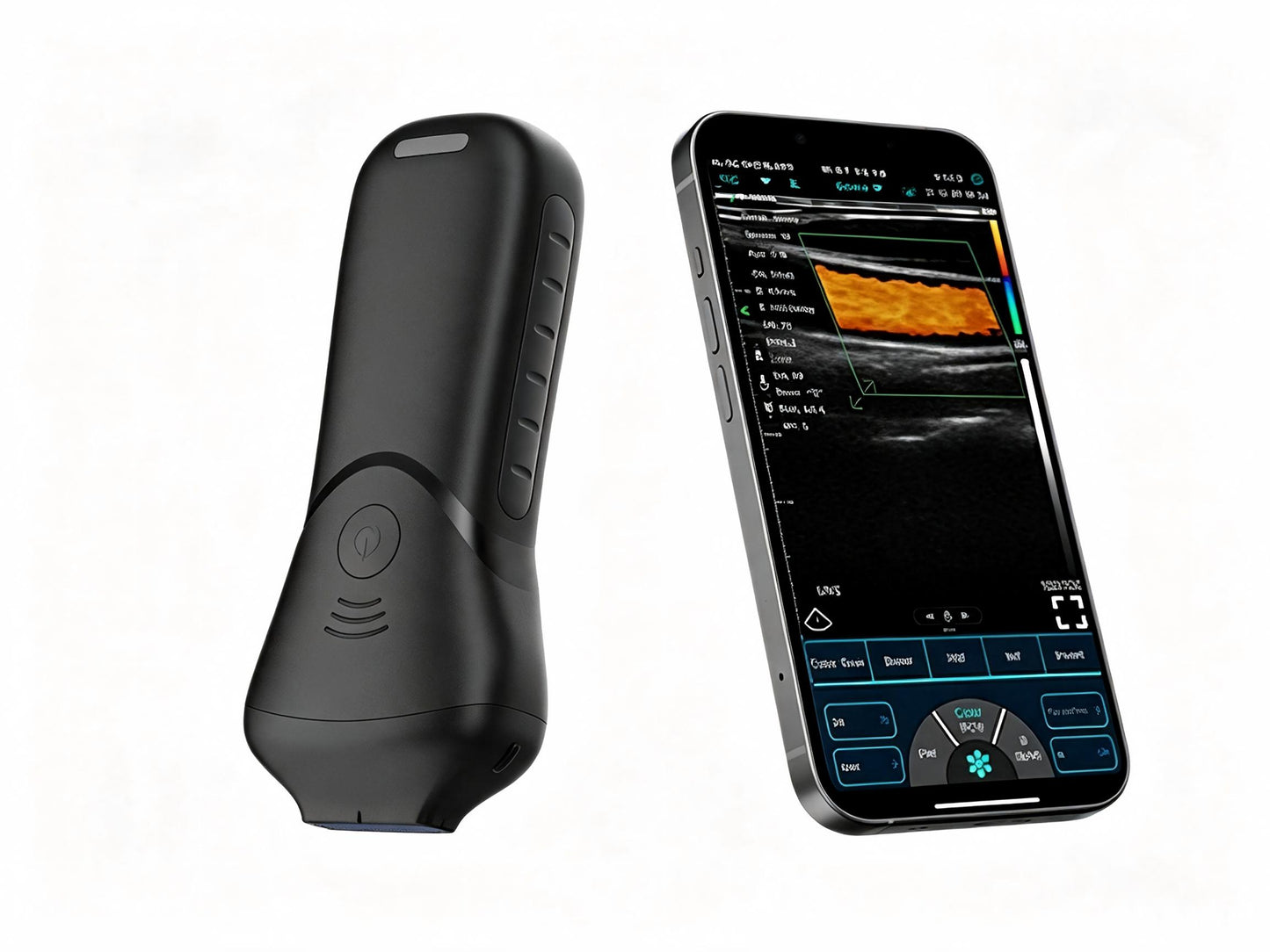 Global Healthcare Medical High-Frequency Linear Ultrasound Probe – 192-Element Wireless Imaging for Superficial & Aesthetic Use