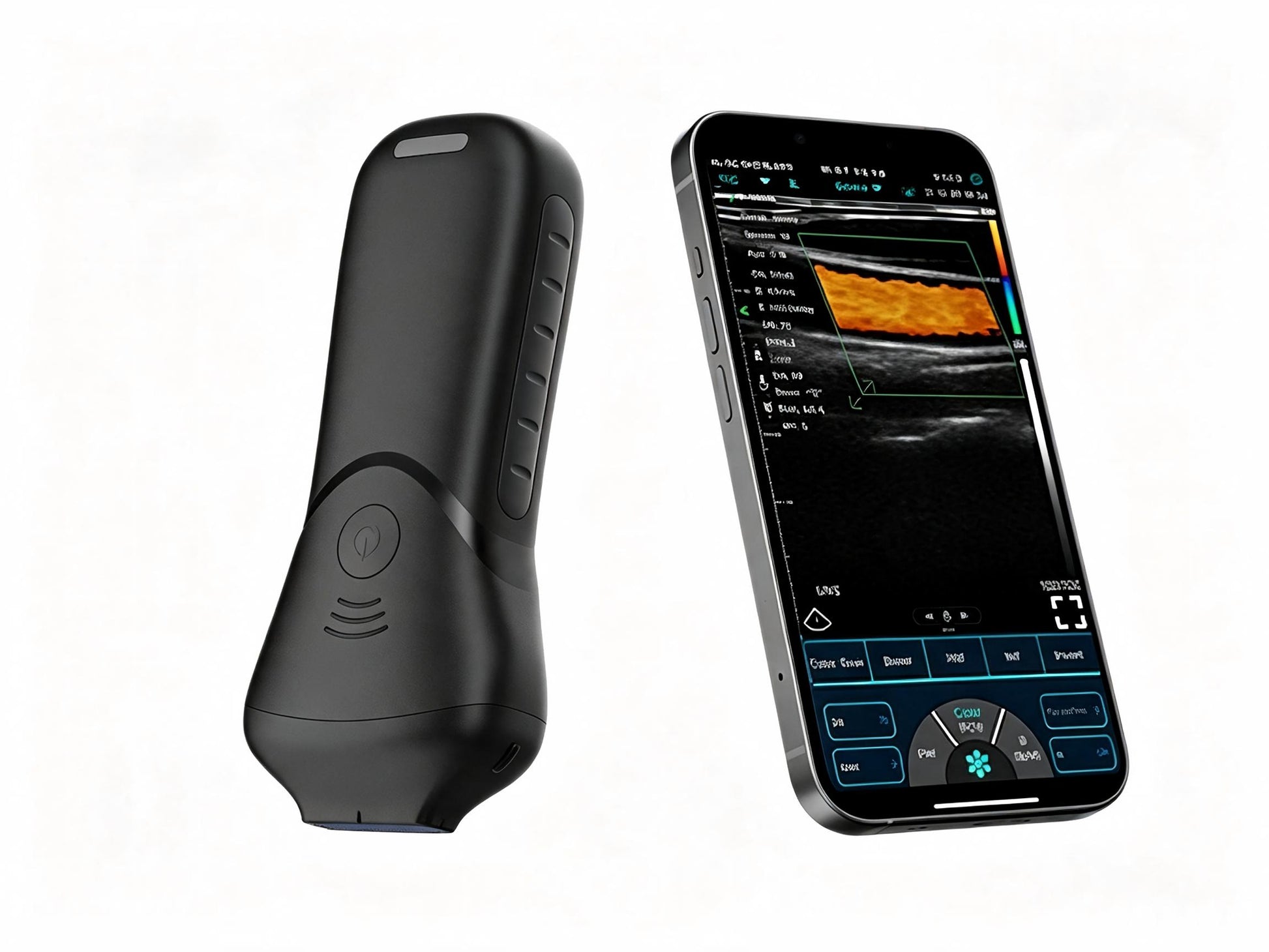 Global Healthcare Medical High-Frequency Linear Ultrasound Probe – 192-Element Wireless Imaging for Superficial & Aesthetic Use