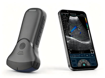 Global Healthcare Medical USB & WiFi Pocket Ultrasound – Wireless Convex Probe for Point‑of‑Care Imaging
