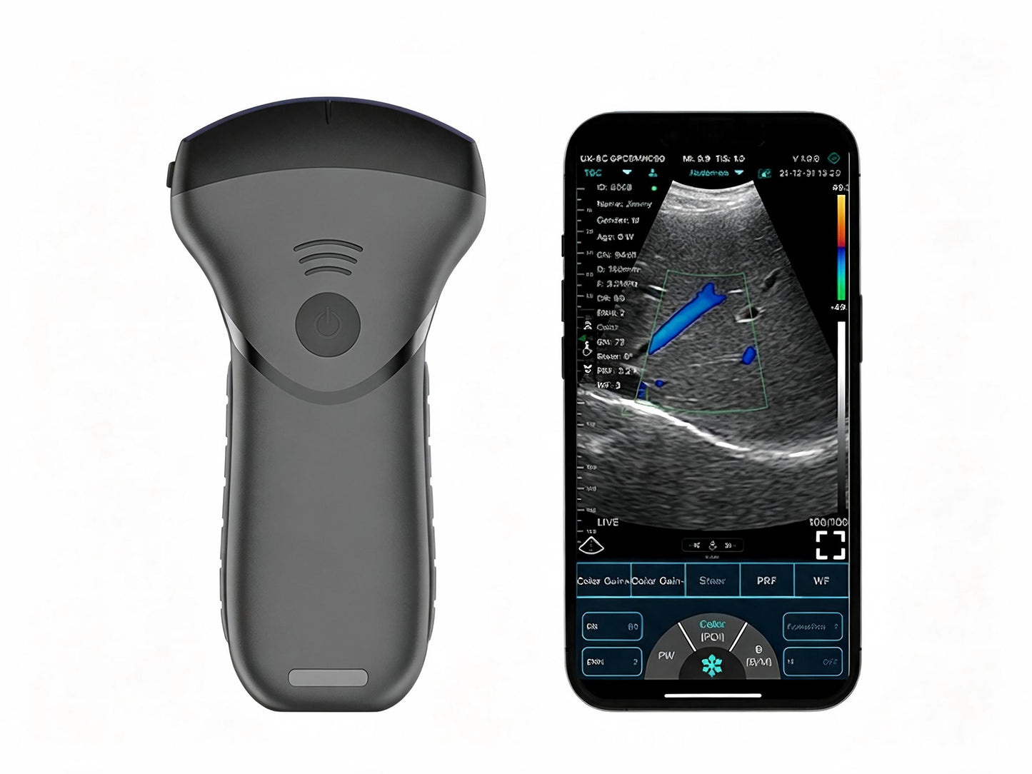 USB & WiFi Pocket Ultrasound | Wireless Convex Probe for Point-of-Care Imaging