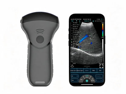 USB & WiFi Pocket Ultrasound | Wireless Convex Probe for Point-of-Care Imaging