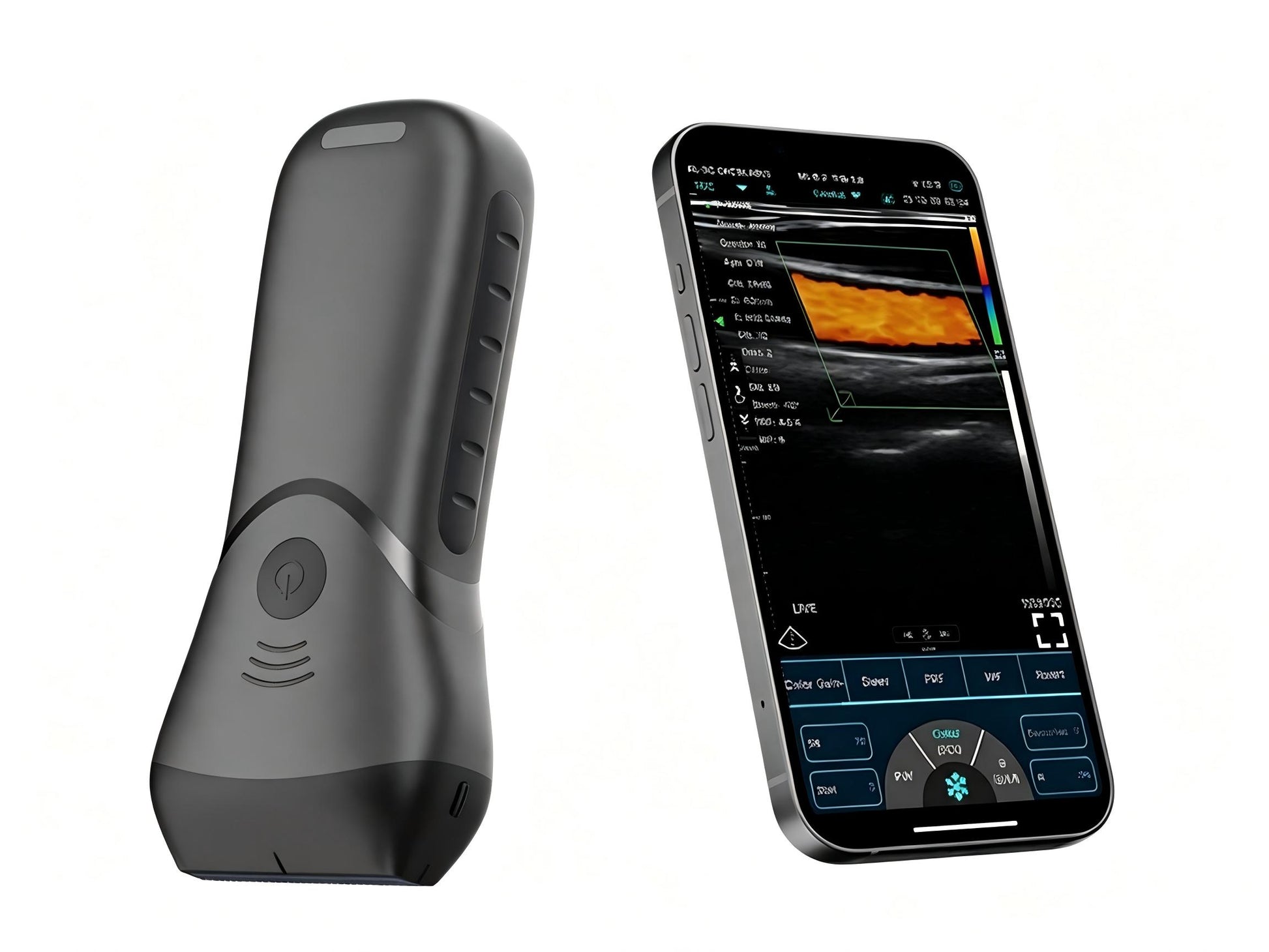 Global Healthcare Medical Color Superficial Ultrasound HD Linear Probe – Pocket‑Sized Wireless Imaging for MSK & Vascular