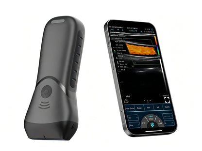 Global Healthcare Medical Color Superficial Ultrasound HD Linear Probe – Pocket‑Sized Wireless Imaging for MSK & Vascular