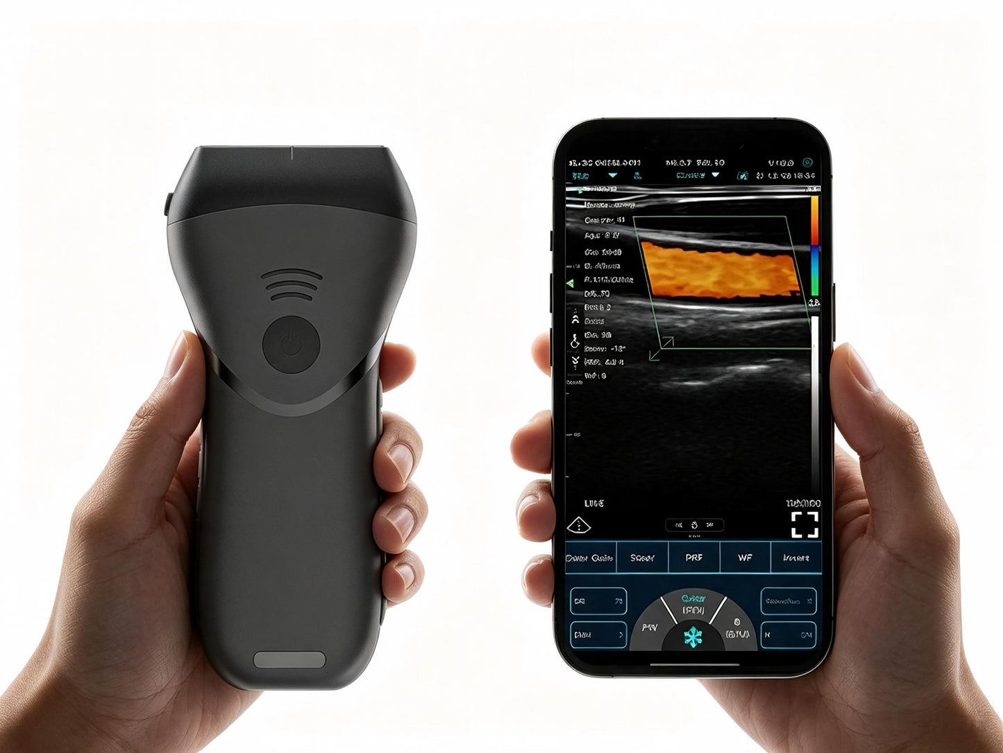 Color Superficial Ultrasound HD Linear Probe | Pocket-Sized Wireless Imaging for MSK & Vascular