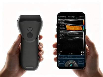 Color Superficial Ultrasound HD Linear Probe | Pocket-Sized Wireless Imaging for MSK & Vascular