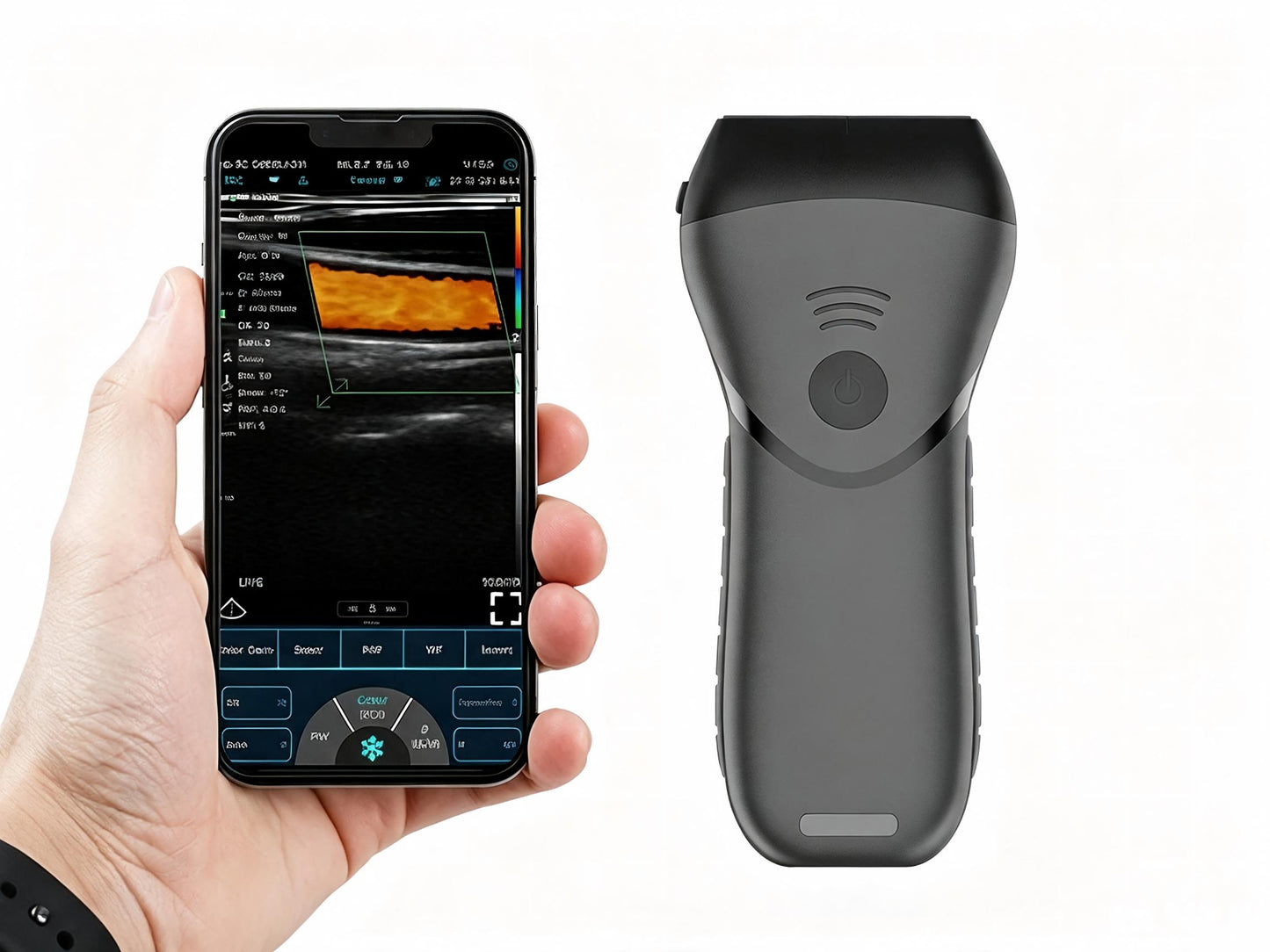 Color Superficial Ultrasound HD Linear Probe | Pocket-Sized Wireless Imaging for MSK & Vascular