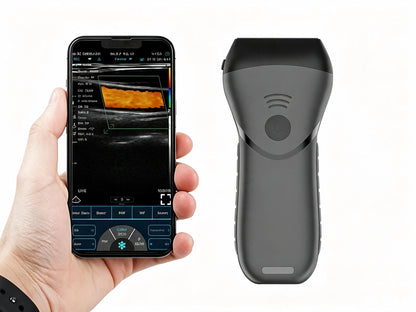 Color Superficial Ultrasound HD Linear Probe | Pocket-Sized Wireless Imaging for MSK & Vascular