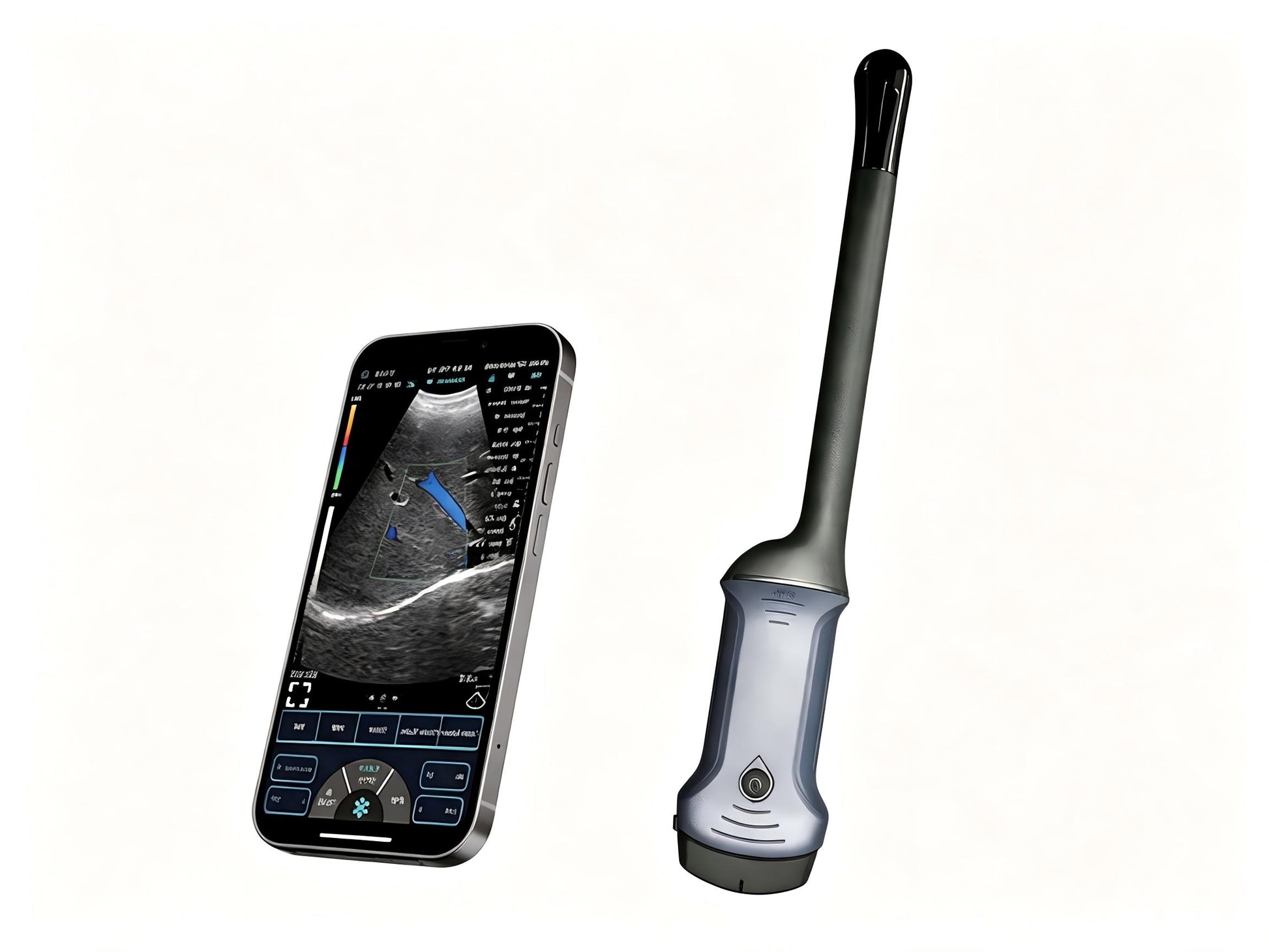 Global Healthcare Medical Wireless Color Doppler Ultrasound – Dual-Head Convex & Endovaginal Probe for OB/GYN
