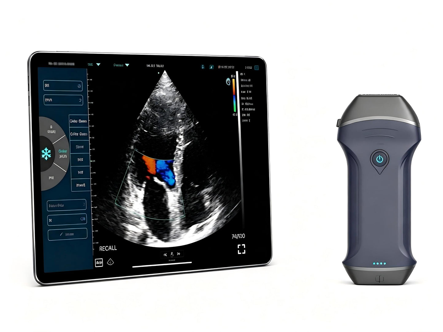Global Healthcare Medical Wireless Color Doppler Ultrasound – Handheld Dual-Head Probe with WiFi & USB