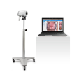 EDAN C3A Video Colposcope