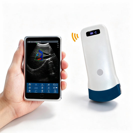 Global Healthcare Medical wireless handheld convex array ultrasound system for abdominal and point-of-care imaging