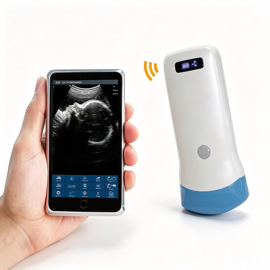 Global Healthcare Medical wireless handheld convex array ultrasound system for abdominal and point-of-care imaging