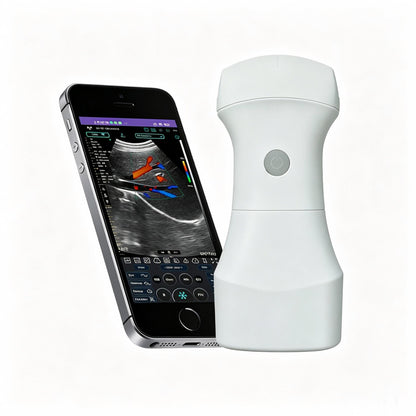 Global Healthcare Medical wireless handheld convex array ultrasound system for abdominal and point‑of‑care imaging