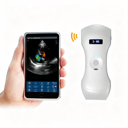 Global Healthcare Medical 3-in-1 wireless handheld ultrasound system with convex, linear, and phased array probes for point-of-care imaging