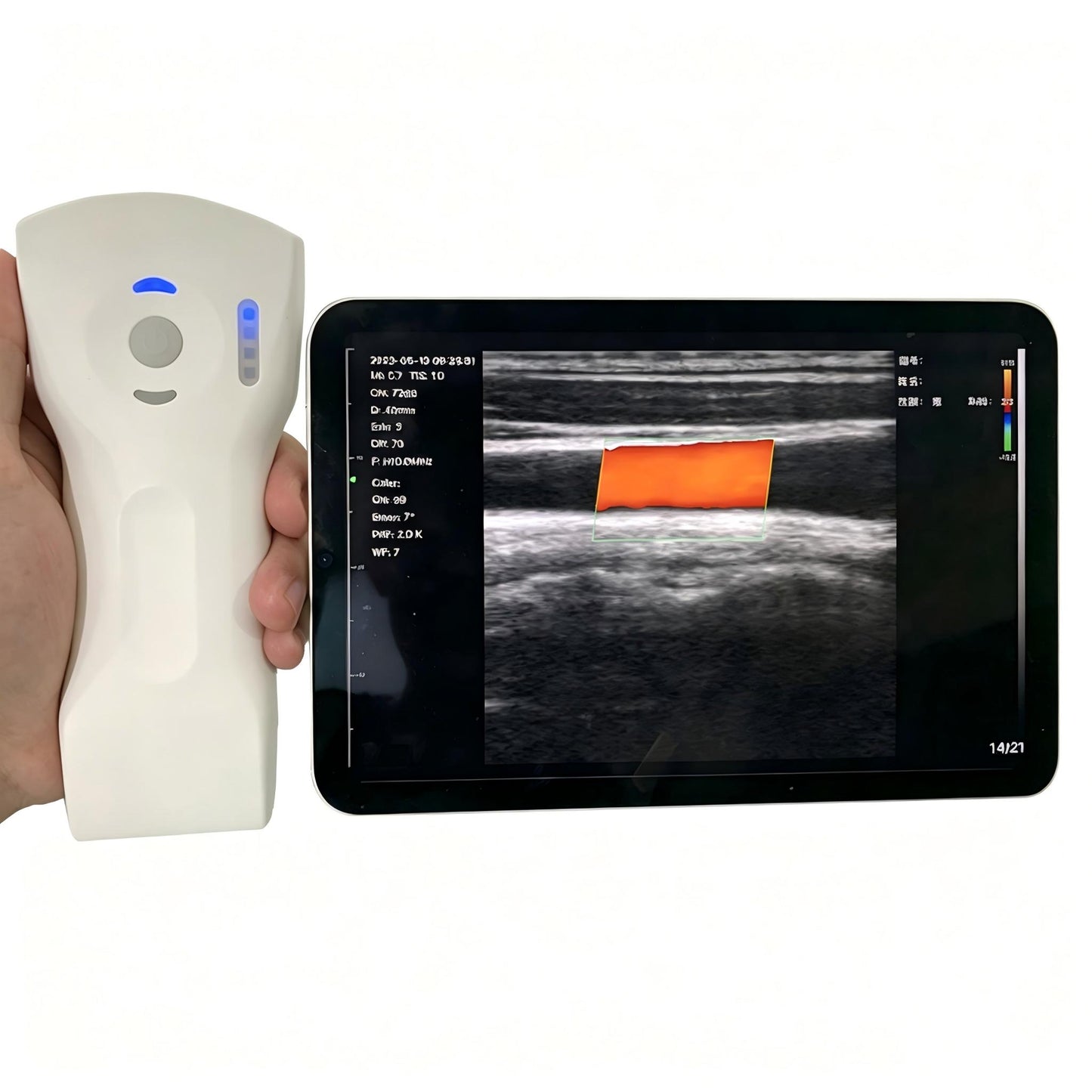Global Healthcare Medical wireless handheld dual‑probe ultrasound system with convex and linear probes for point‑of‑care imaging