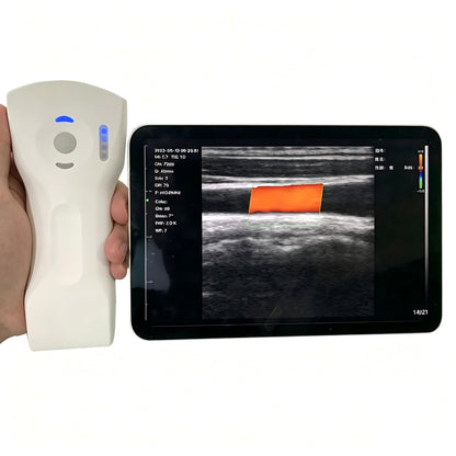 Global Healthcare Medical wireless handheld dual‑probe ultrasound system with convex and linear probes for point‑of‑care imaging