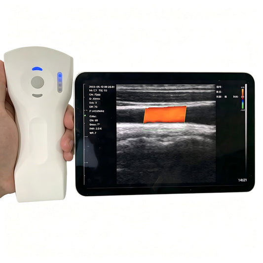 Global Healthcare Medical wireless handheld dual‑probe ultrasound system with convex and linear probes for point‑of‑care imaging