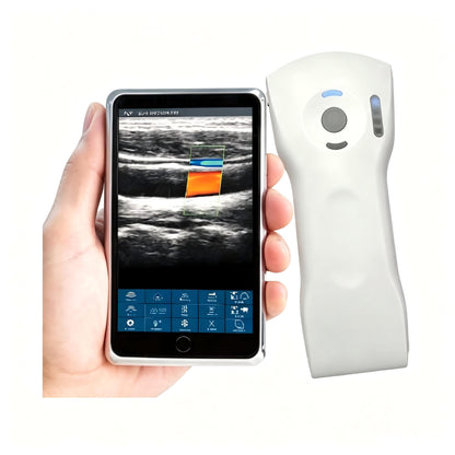 Global Healthcare Medical wireless handheld dual‑probe ultrasound system with convex and linear probes for point‑of‑care imaging