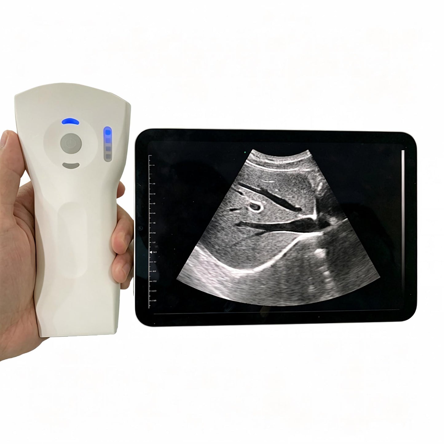 Global Healthcare Medical wireless handheld dual‑probe ultrasound system with convex and linear probes for point‑of‑care imaging