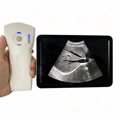 Global Healthcare Medical wireless handheld dual‑probe ultrasound system with convex and linear probes for point‑of‑care imaging