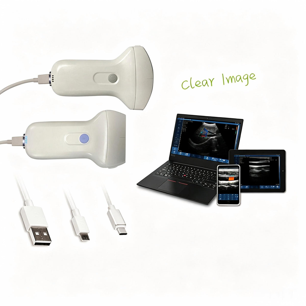 Global Healthcare Medical linear wireless handheld ultrasound system with USB and WiFi connectivity for musculoskeletal and vascular point-of-care imaging