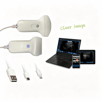 Global Healthcare Medical linear wireless handheld ultrasound system with USB and WiFi connectivity for musculoskeletal and vascular point-of-care imaging