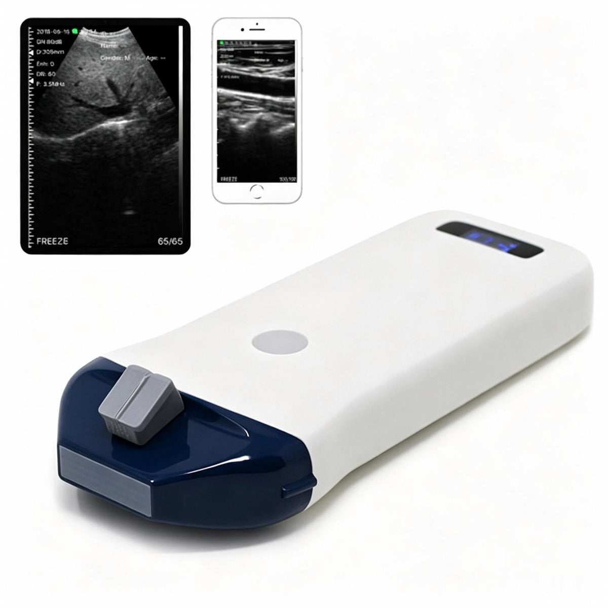 Global Healthcare Medical high‑frequency wireless linear ultrasound system with guide pin holder for vascular access and point‑of‑care imaging