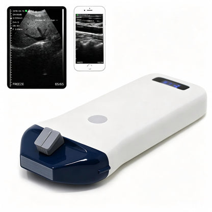 Global Healthcare Medical high‑frequency wireless linear ultrasound system with guide pin holder for vascular access and point‑of‑care imaging