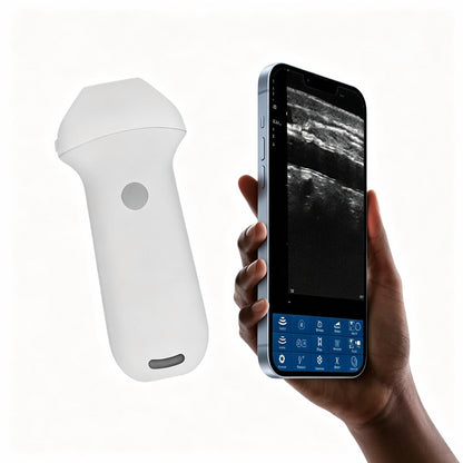 Global Healthcare Medical high‑frequency wireless linear ultrasound system with replaceable battery for musculoskeletal and vascular point‑of‑care imaging