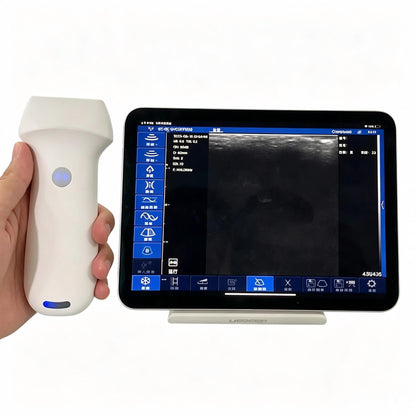 Global Healthcare Medical high-frequency wireless linear ultrasound system with replaceable battery for musculoskeletal and vascular point-of-care imaging