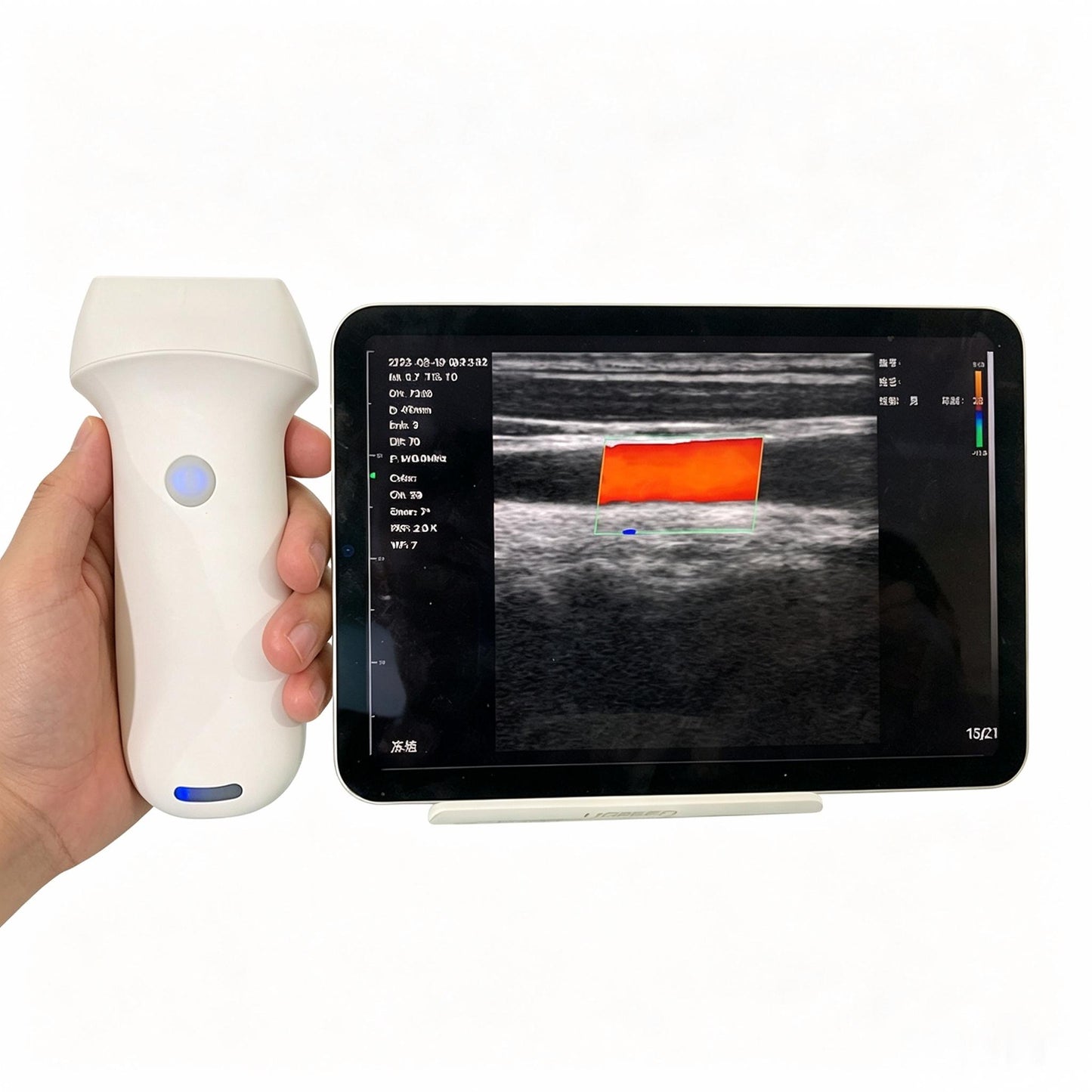 Global Healthcare Medical high-frequency wireless linear ultrasound system with replaceable battery for musculoskeletal and vascular point-of-care imaging