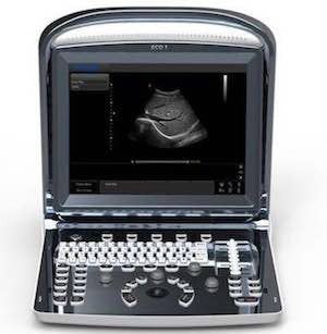 Chison ECO1 Vet Ultrasound #