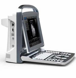 Chison ECO1 Vet Ultrasound #