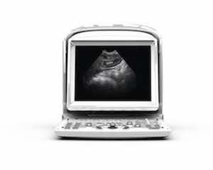 Chison ECO3 Vet Ultrasound #