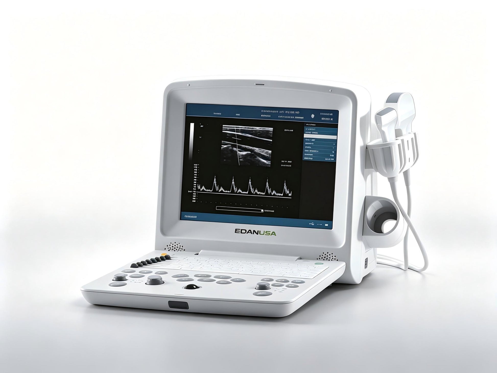 EDAN DUS 60 portable digital ultrasound system with 12.1-inch display and convex transducer