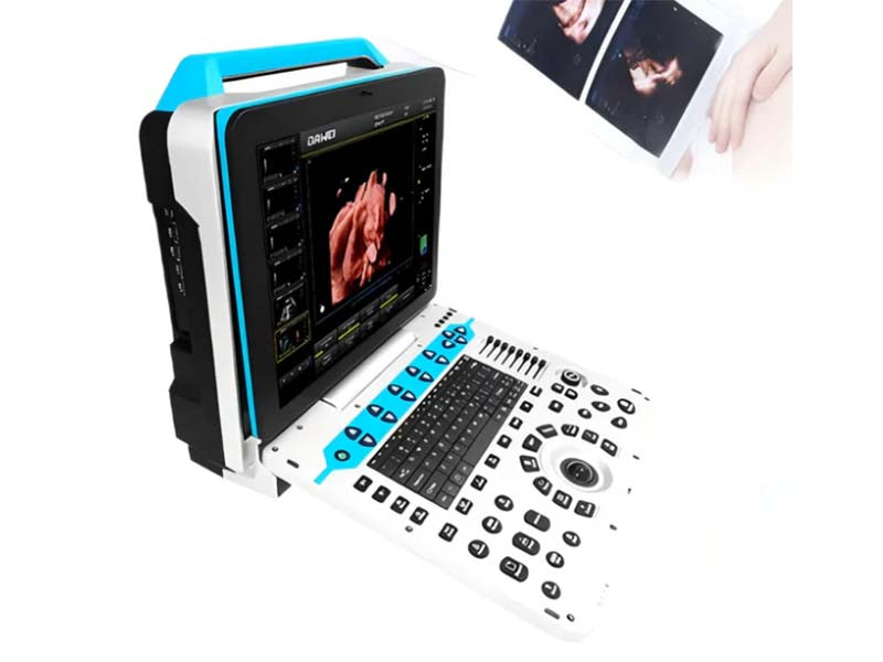 GHM-P30 best 4D/5D color doppler portable ultrasound diagnosis system
