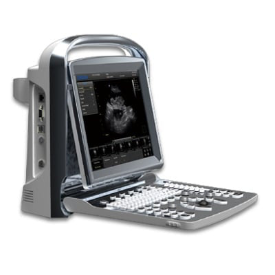 Chison ECO1 Vet Ultrasound #